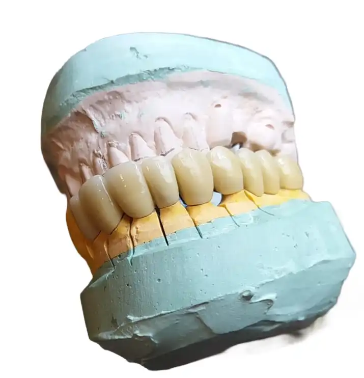 High quality dental crown prosthetic detailed shot